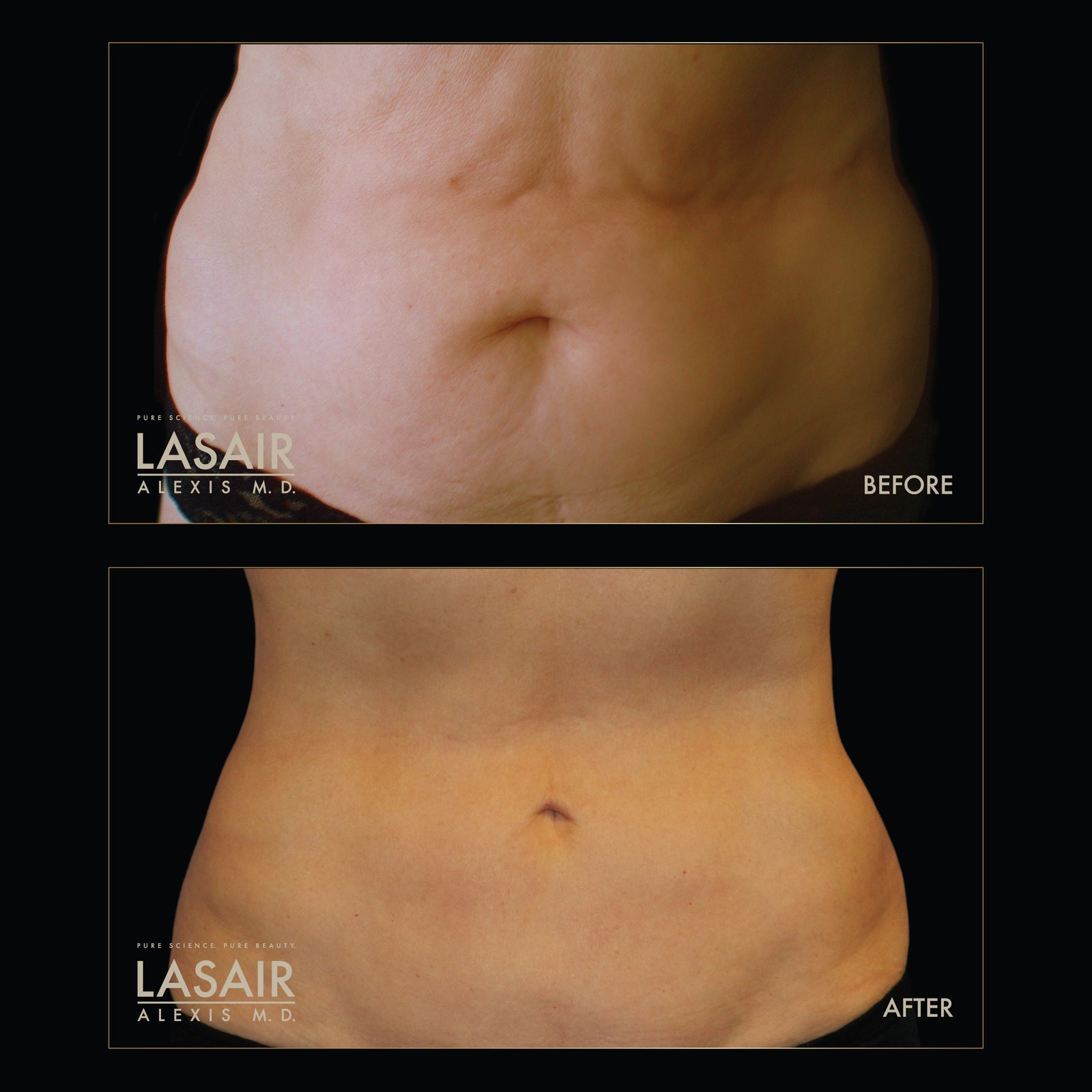 THE CURSE OF THE “MENOPOT”